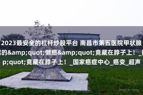 2023最安全的杠杆炒股平台 南昌市第五医院甲状腺科：年轻人集体中招的&quot;懒癌&quot;竟藏在脖子上！_国家癌症中心_癌变_超声