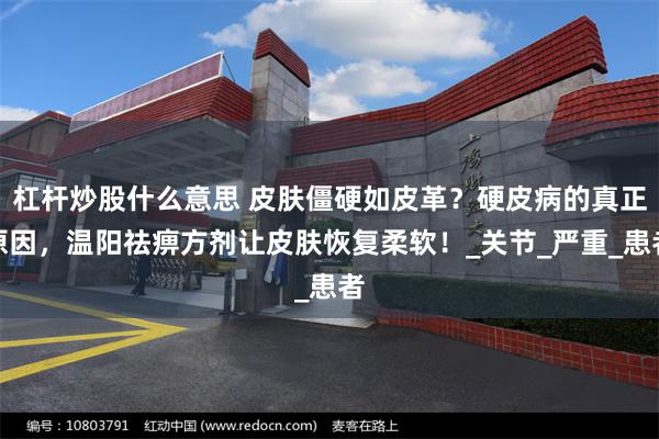 杠杆炒股什么意思 皮肤僵硬如皮革？硬皮病的真正原因，温阳祛痹方剂让皮肤恢复柔软！_关节_严重_患者